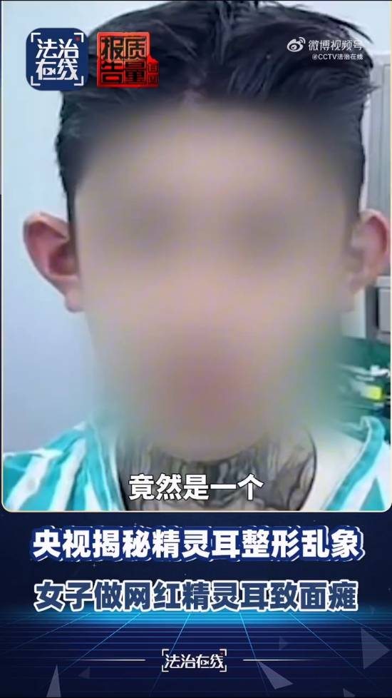 央视揭秘“精灵耳”整形乱象！有人面瘫无法闭眼