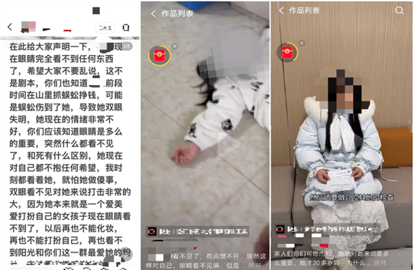 虚假“蜈蚣致盲”事件引发关注