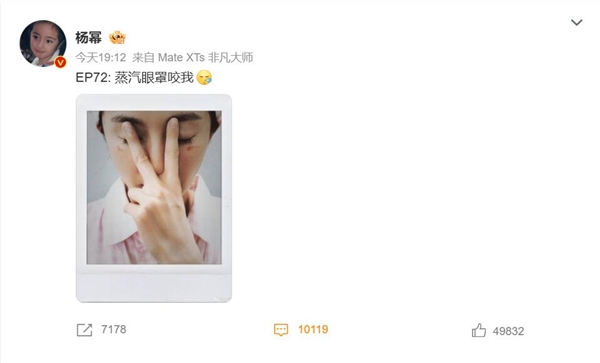 杨幂脸被蒸汽眼罩烫伤了：大家使用时要小心